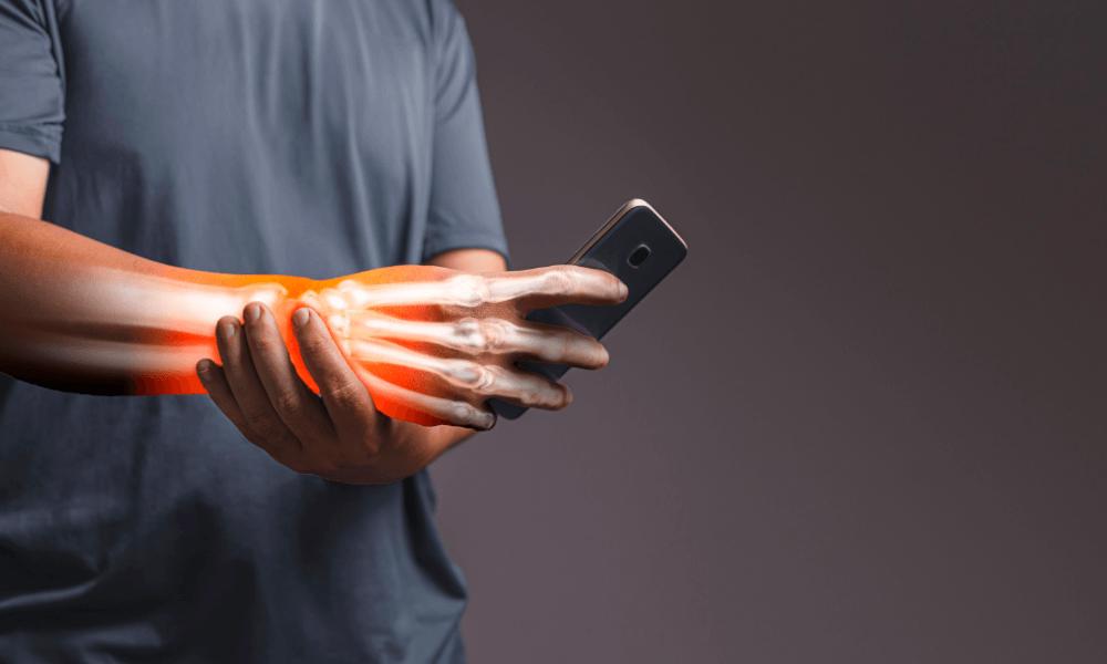 Carpal Tunnel A person holds a smartphone, with an overlay of a glowing skeletal arm and hand, illustrating the effects of prolonged phone use.